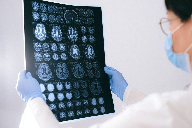Brain Bypass Surgery STA-MCA