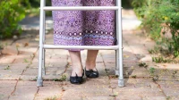 Tanda osteoporosis